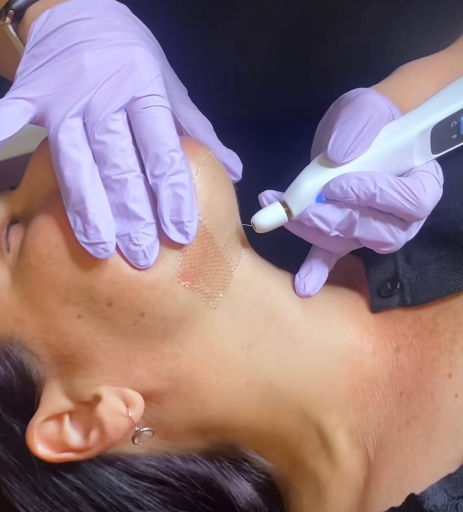 Neck treatment being performed